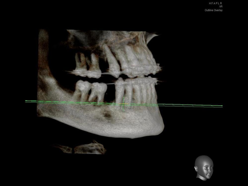 Dental x ray view