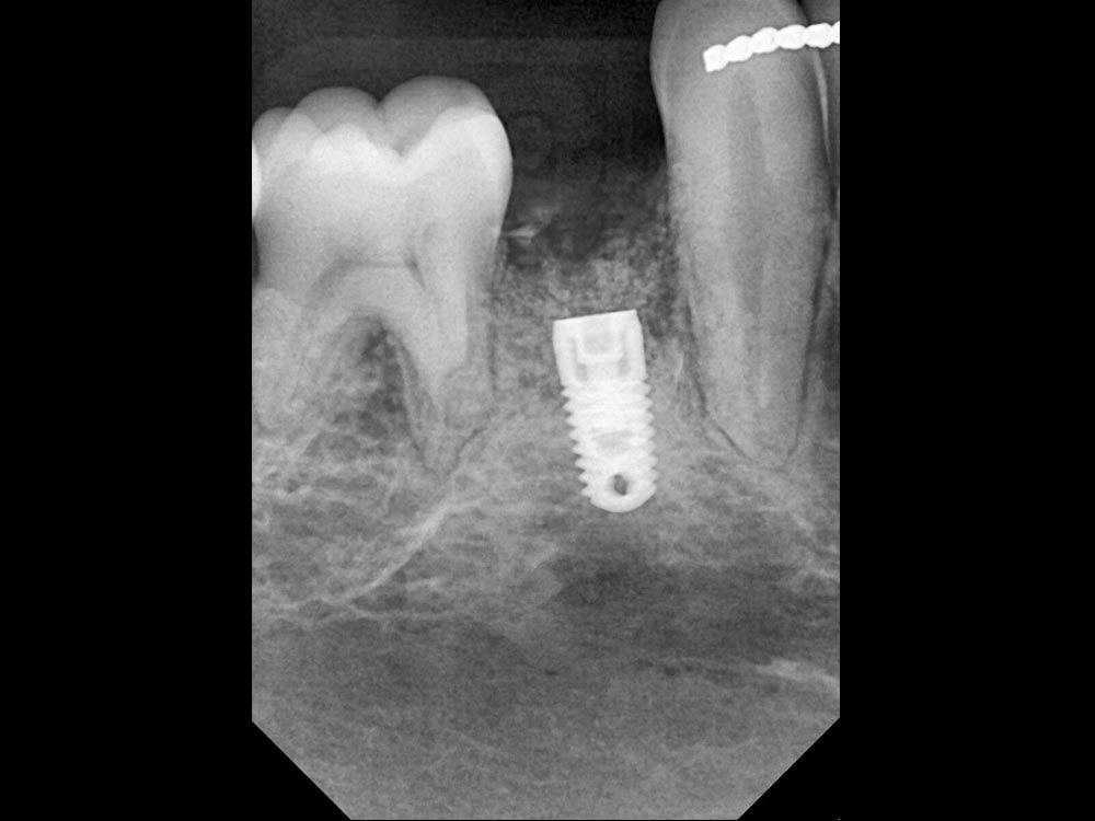 Dental x ray View