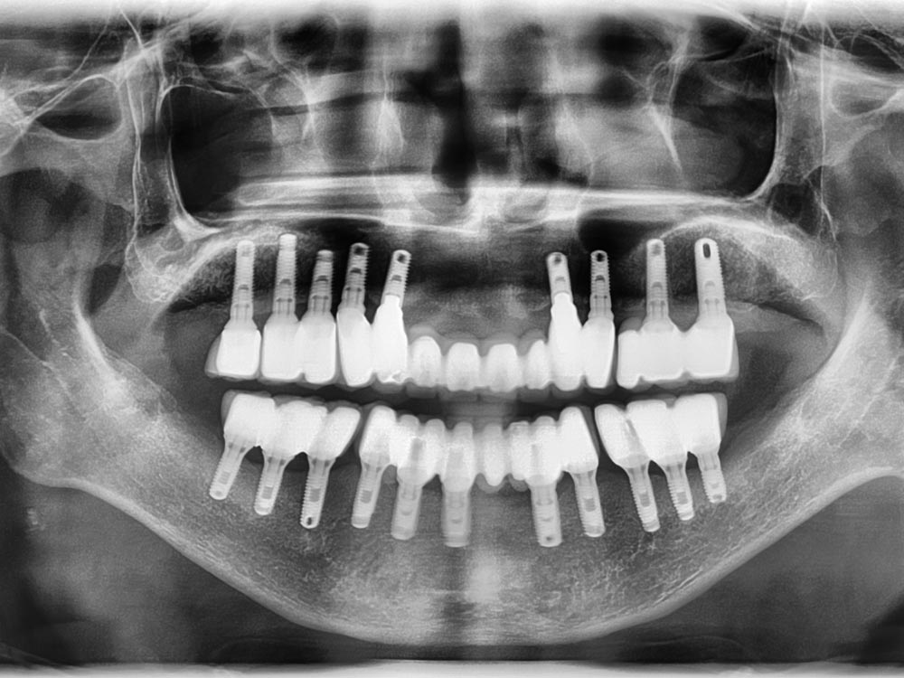 Dental X ray view